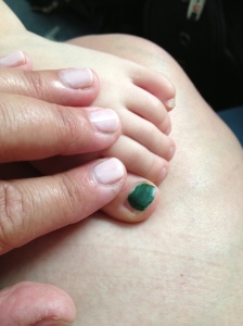 Evs big green toe