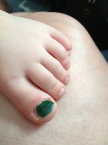 Evs big green toe2
